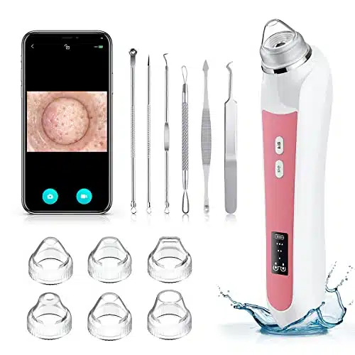 Blackhead Remover Vacuum, Black Head Extractions Tool With Camera For Usb Interface Type Pore Vacuum, Men And Women Pore Cleaner, Suction Heads &Amp; Adjustment Modes (Pink)